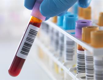 الايدز (AIDS ,HIV)